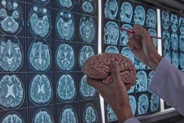 Hipnoterapia e ansiedade — amígdala e reconsolidação de memória