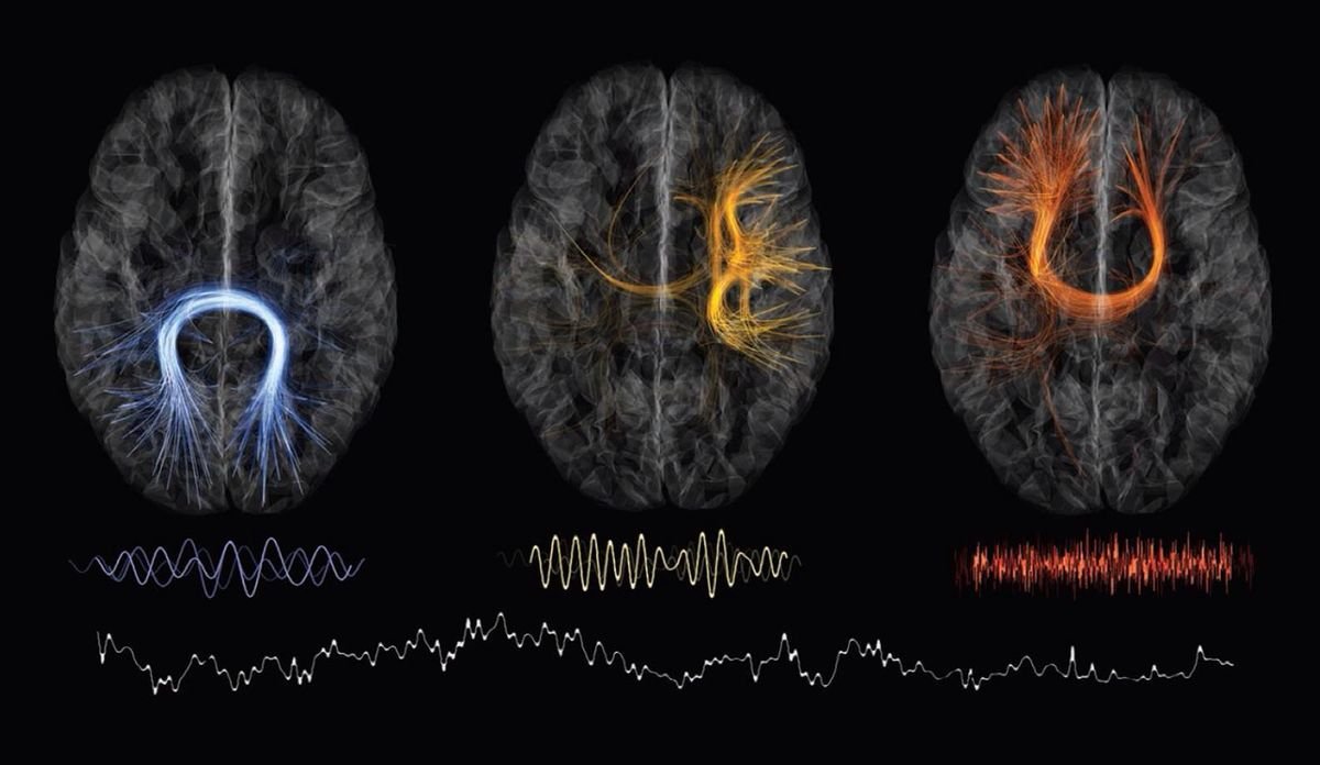 Sono REM: O Estágio que Regula Suas Emoções, Alimenta Sua Criatividade e Foi o Que Você Perdeu Ontem à Noite